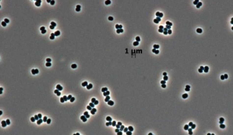 Microbe Survival