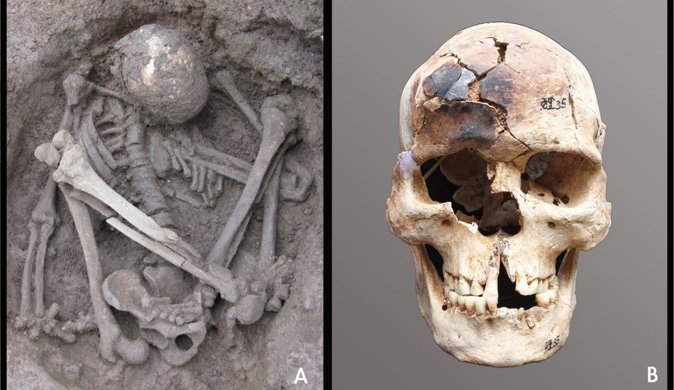 imageAncient Mummification