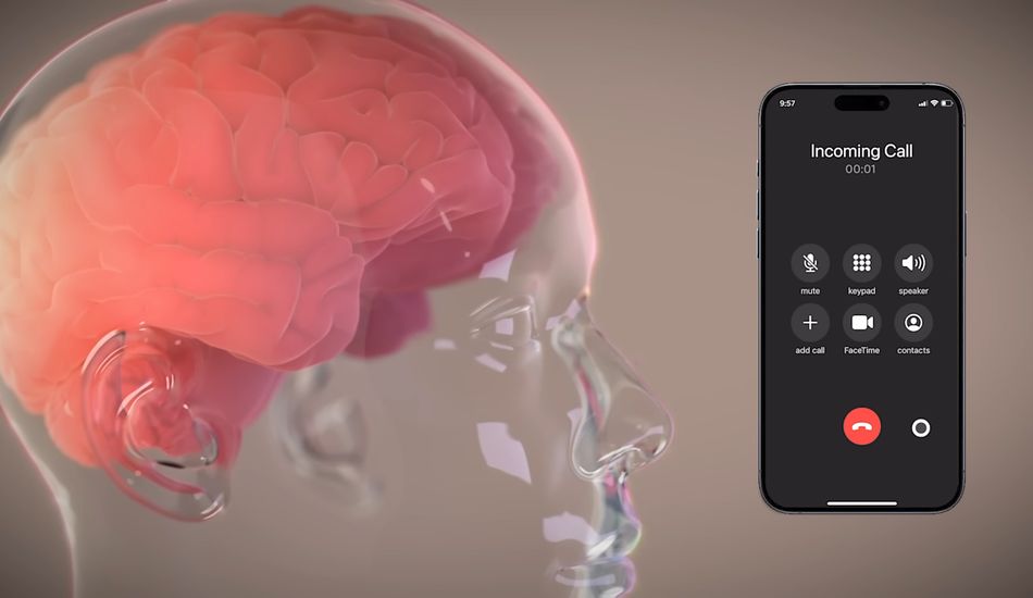 Neuralink Trial